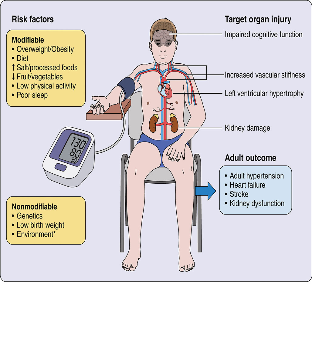 Pediatric Primary Hypertension: An Underrecognized Condition: A Scientific Statement From the American Heart Association