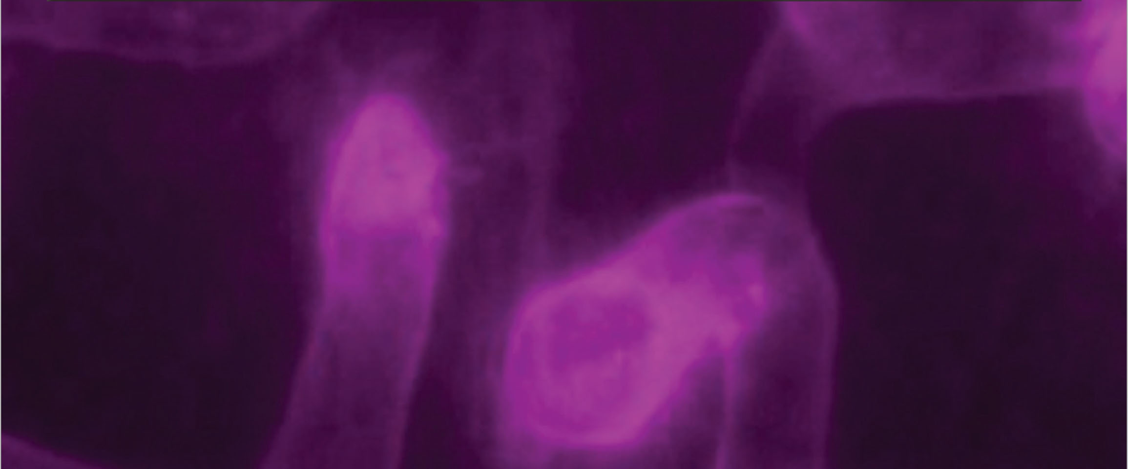 arteriosclerosis thrombosis and vascular biology aha asa journals