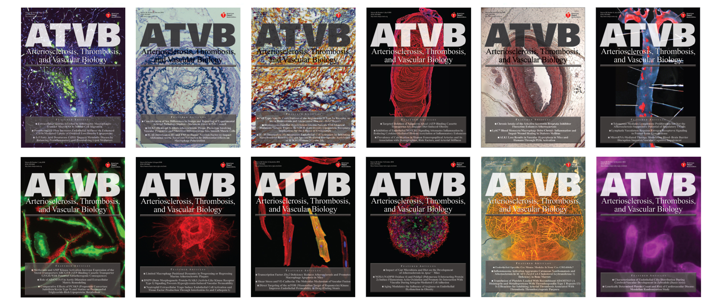 Arteriosclerosis Thrombosis And Vascular Biology Ahaasa - 