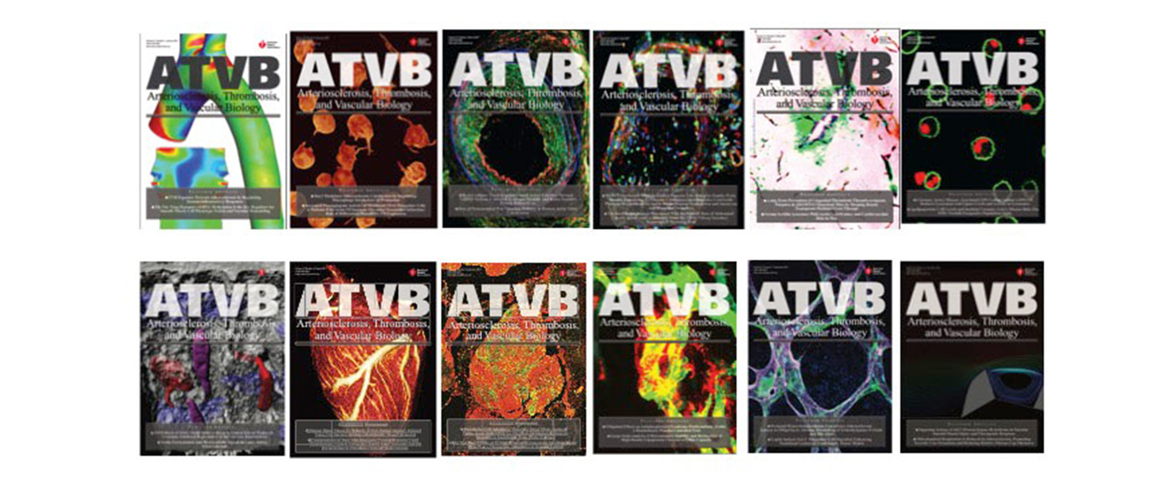 arteriosclerosis thrombosis and vascular biology aha asa journals