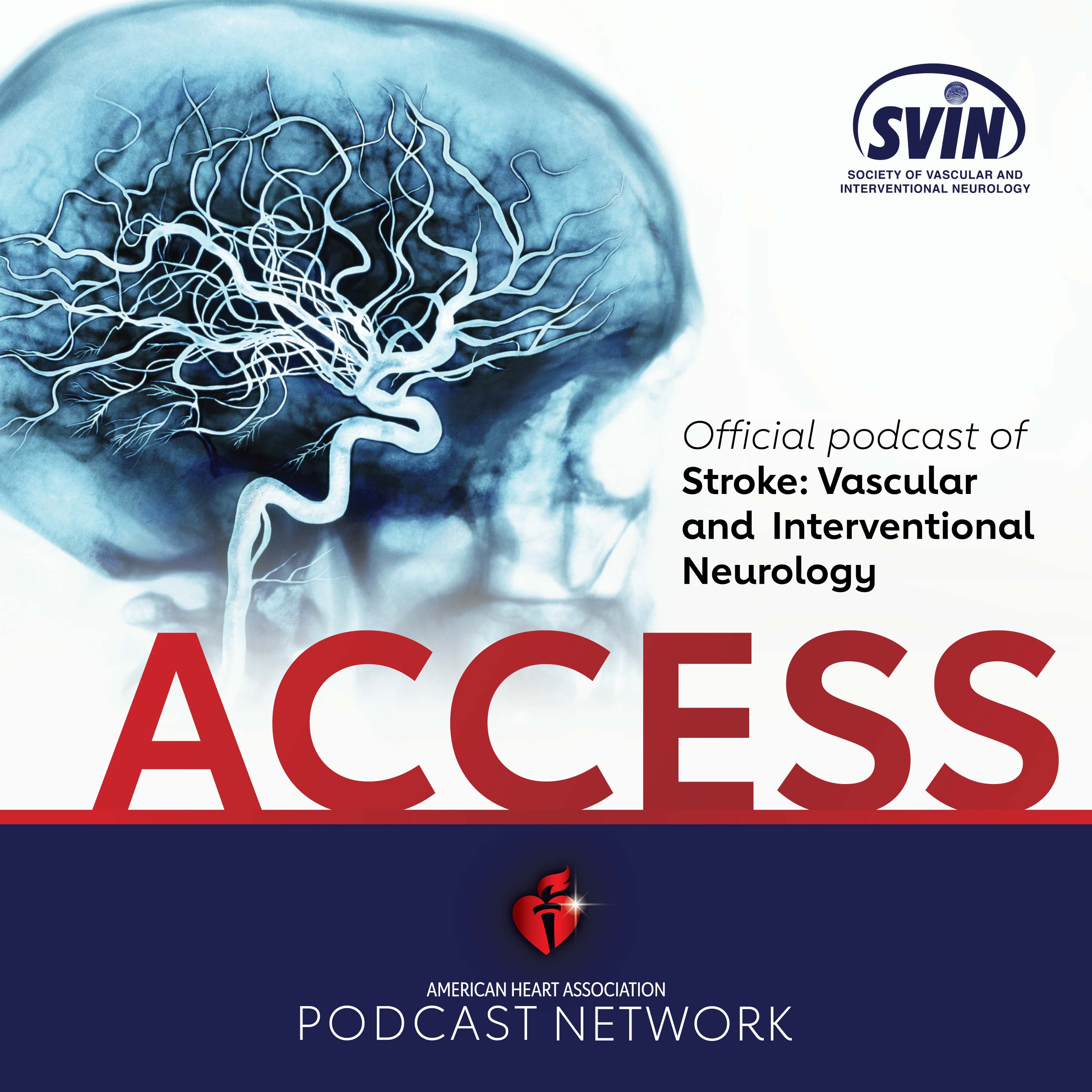 ACCESS S:VIN